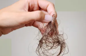 Diffuse Hair Loss hero