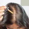 Minoxidil for Hair Loss Benefits, Limitations, and Gentle Alternatives (1)