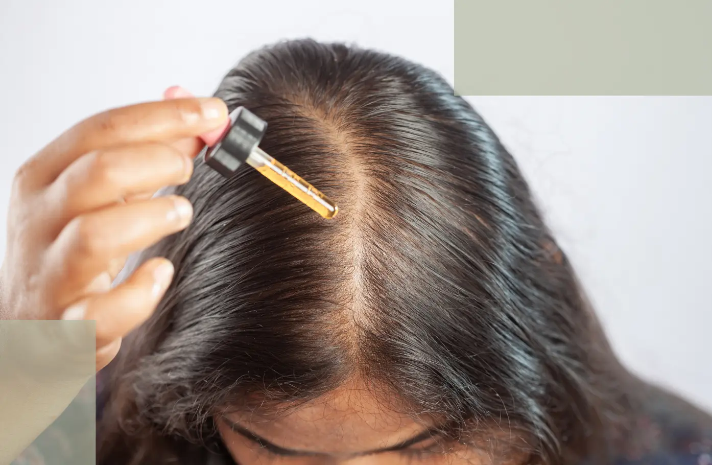 Minoxidil for Hair Loss Benefits, Limitations, and Gentle Alternatives (1)