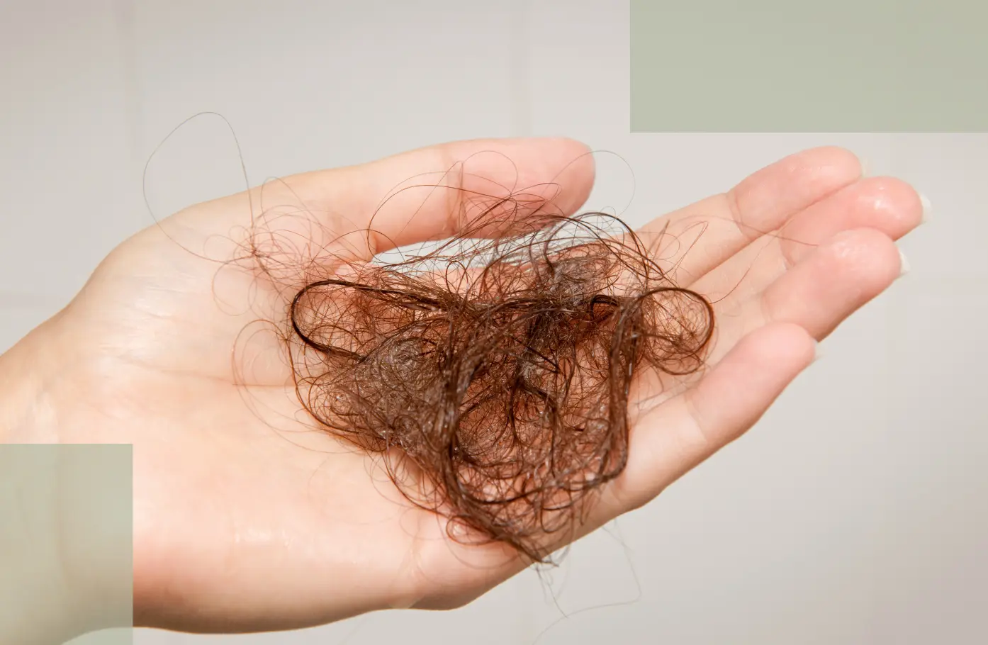 Thyroid Hair Loss