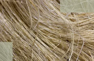 Barrier Repair The Overlooked Foundation That Determines Postpartum Hair-Loss Recovery Speed