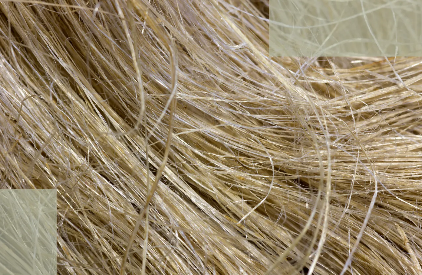 Barrier Repair The Overlooked Foundation That Determines Postpartum Hair-Loss Recovery Speed