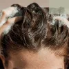 Why Scalp Routine Matters So Much for Postpartum Hair Loss Recovery