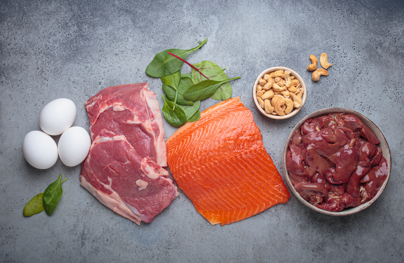 Ferritin, Vitamin D, and ProteinWhy They Still Matter in Hormonal Hair Loss — But Are Not “Single-Cause Fixes”