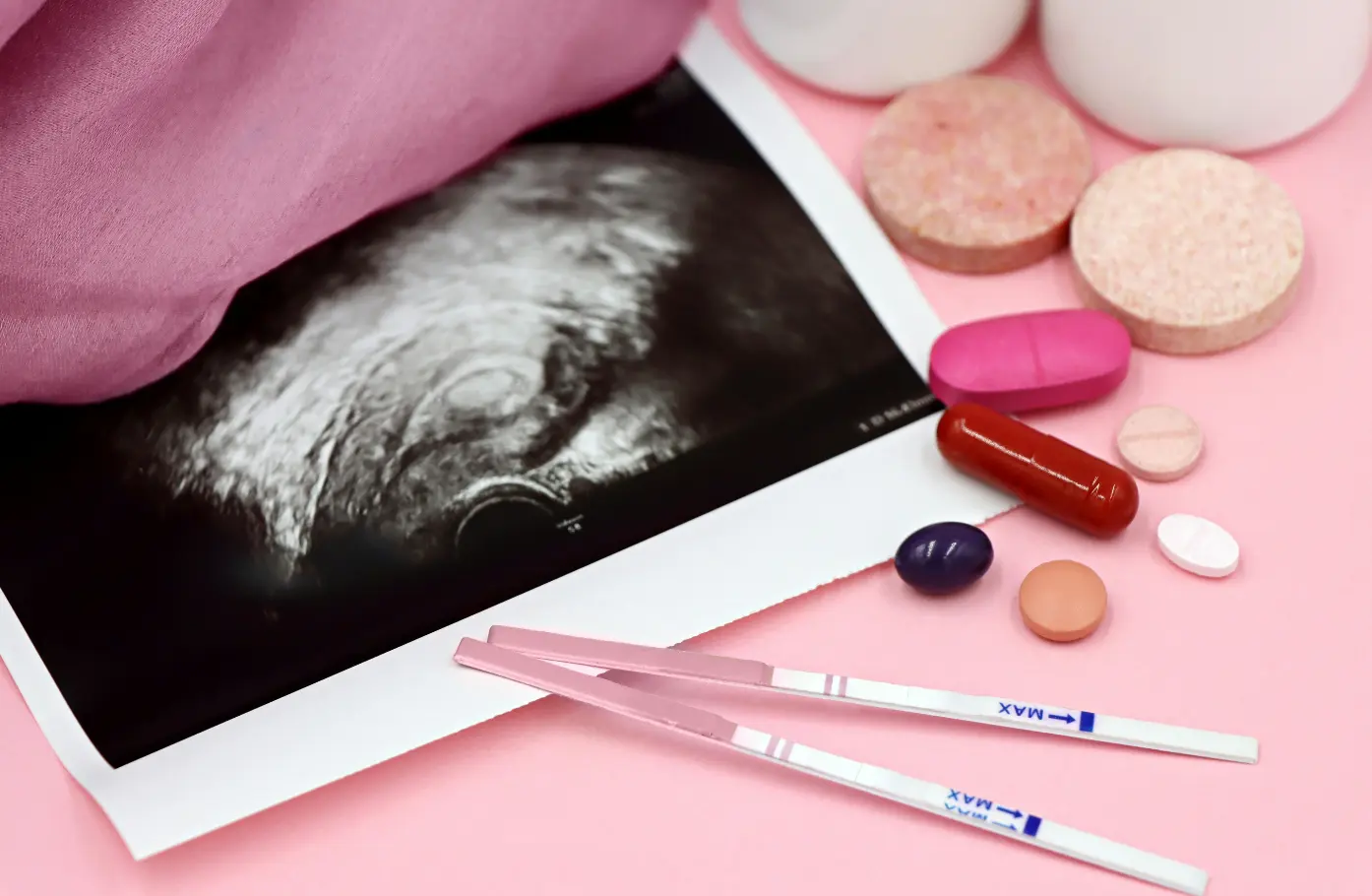 Hormonal Hair Loss Isn’t a Sign of a “Weak Body” —It’s About Hair Follicles Being More Sensitive to Hormonal Signals