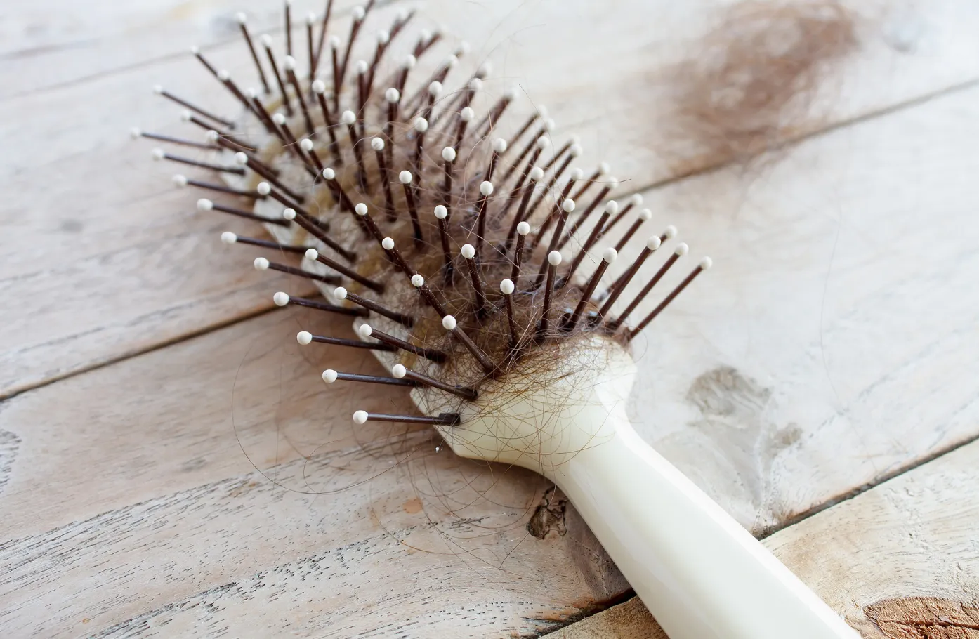 Hormonal Hair Loss Recovery Step Six — Why Hormonal Hair Loss Is Most Likely to Relapse When You “Stop Once It Looks Better”