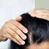How to Care for Stress Hair Loss Why Real Recovery Comes from Stability, Not Stimulation