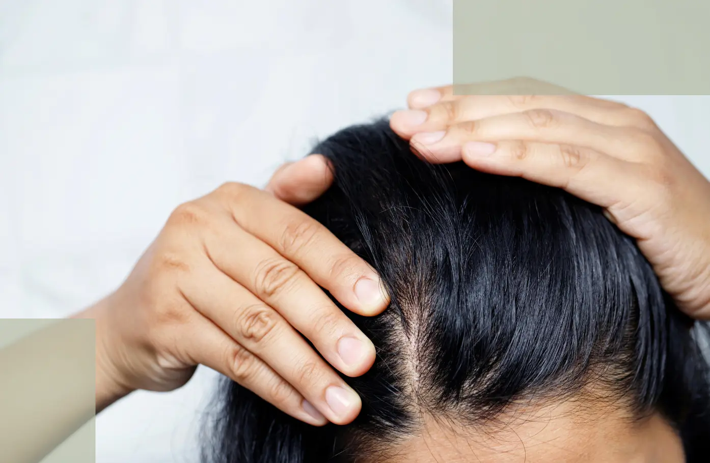 How to Care for Stress Hair Loss Why Real Recovery Comes from Stability, Not Stimulation