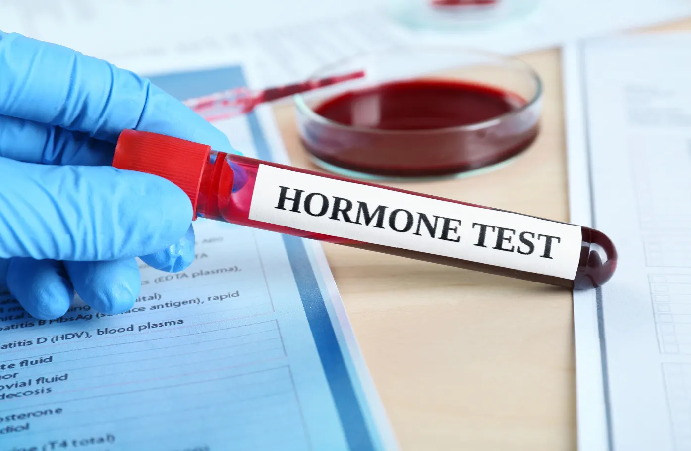 “Is Checking Hormones Enough”Which Tests Actually Inform — and Which Are Most Often Misinterpreted (A Practical Guide)