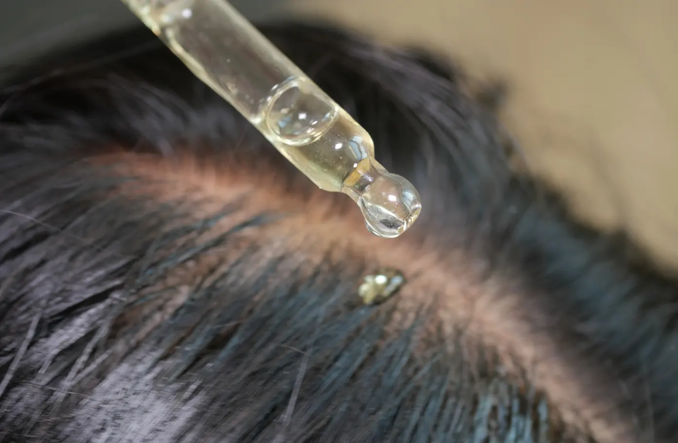 “Is Less Oil Always Better” Why Hormonal Oily Scalps Are More Vulnerable to Harsh Cleansing