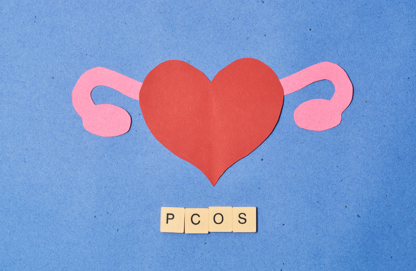 The Shame Around PCOS Hair Loss Why So Many People Don’t Dare to Talk About It
