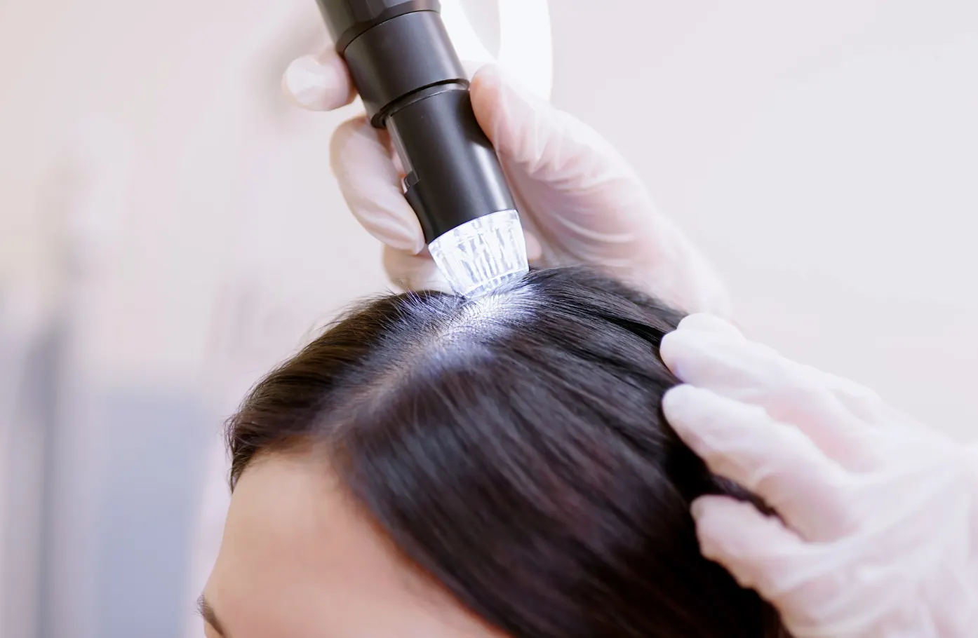Barrier Repair Ingredients Why the Scalp Becomes More Sensitive During Nutritional Deficiency