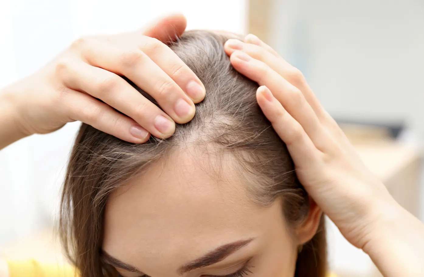 Chronic Blood Loss (Heavy Menstrual Flow) and Iron DeficiencyWhy This Is One of the Most Common Causes of Hair Loss in Women