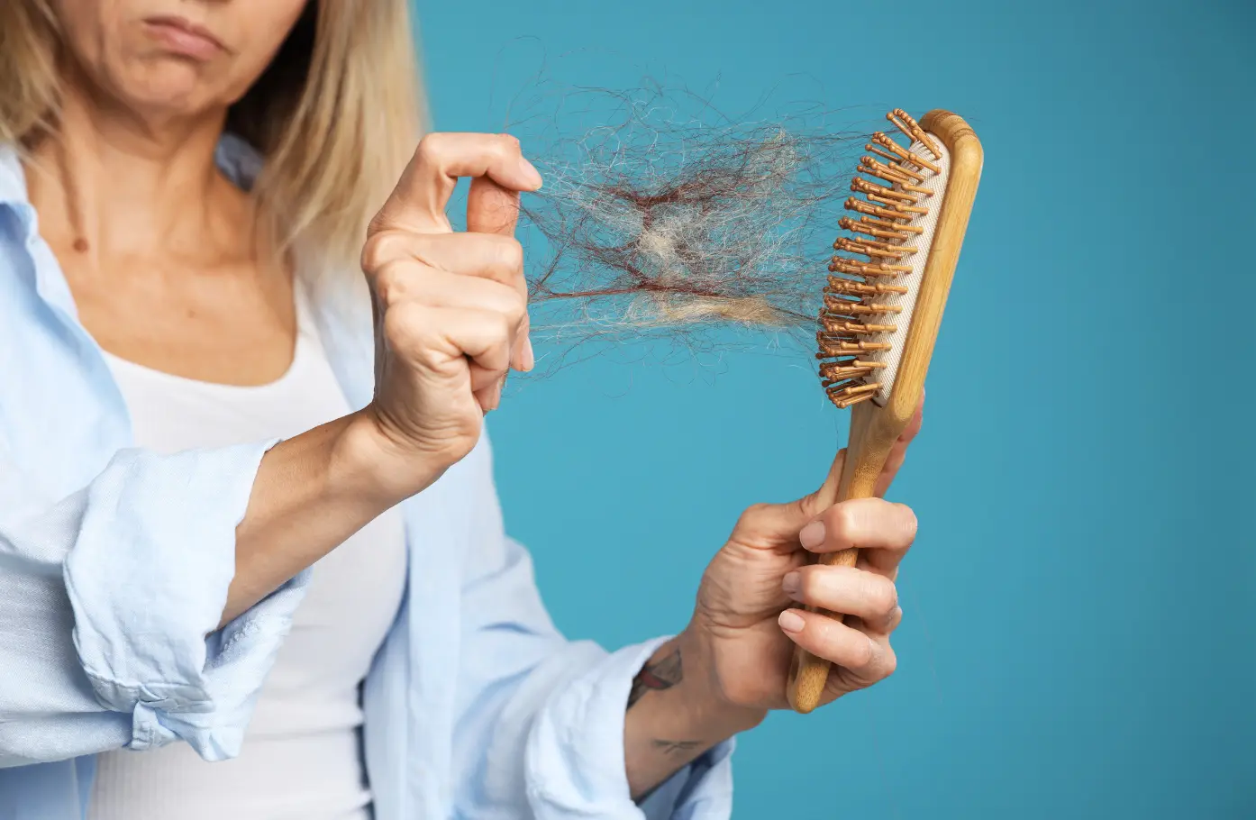 “Just Take What You’re Missing” — Why Hair Loss Is a System Issue, Not a Single Nutrient Problem