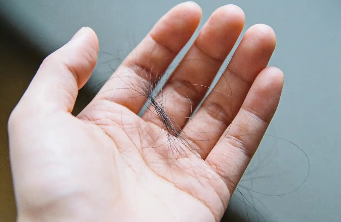 Mechanism 3 Why Low Ferritin Keeps Your Hair Falling — Hair Follicles Lose “Growth Permission”