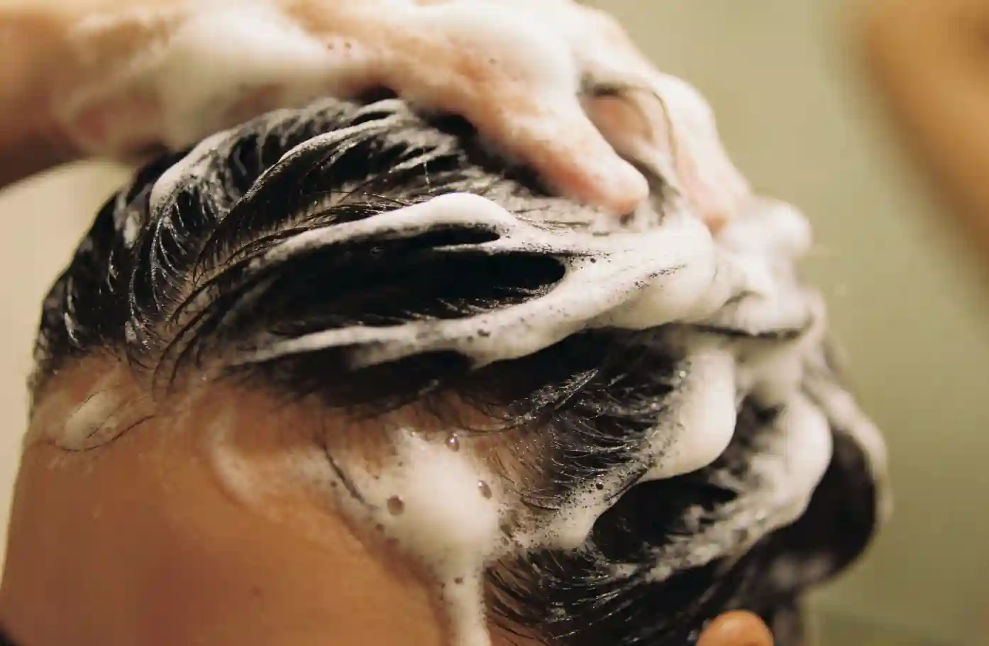 Why Scalp Routine Still Matters in Nutrient Deficiency–Related Hair Loss