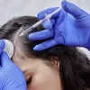 Dormant vs Dead Hair Follicles Can Hair Really Regrow