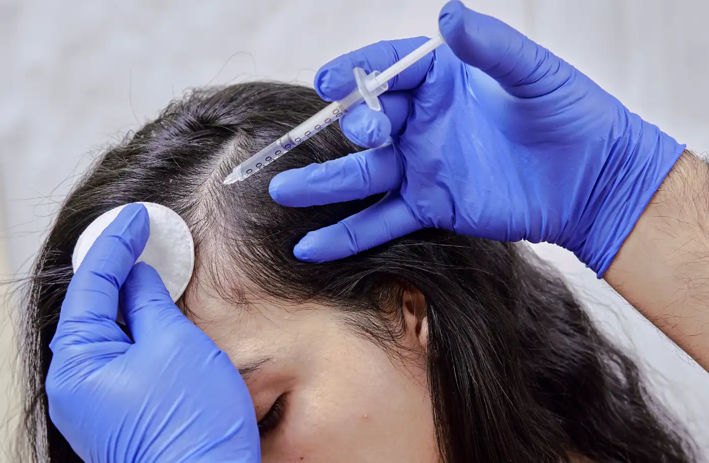 Dormant vs Dead Hair Follicles Can Hair Really Regrow