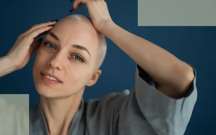 Causes of Female Hair Loss Baldness A Comprehensive and Gentle Guide from Evavitae