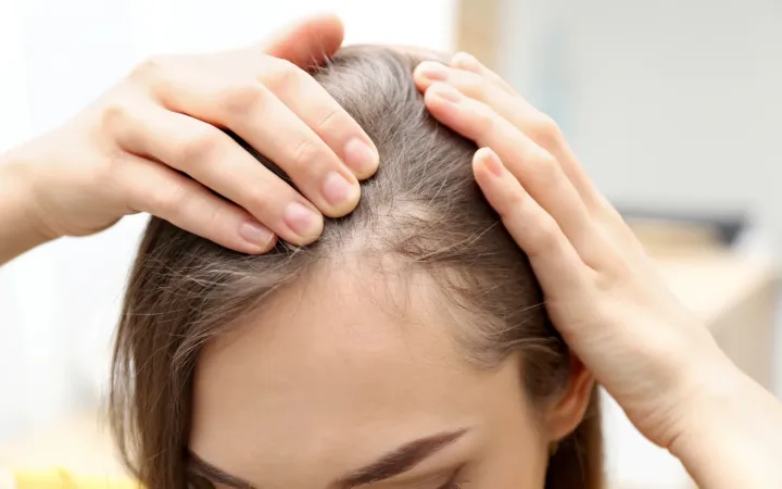 Chronic Blood Loss (Heavy Menstrual Flow) and Iron DeficiencyWhy This Is One of the Most Common Causes of Hair Loss in Women
