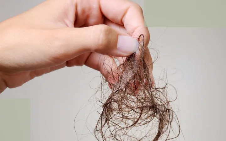 Diffuse Hair Loss hero