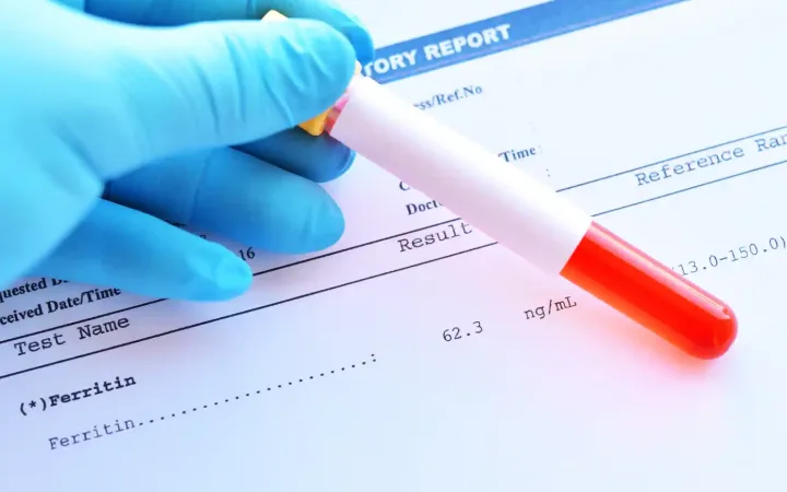 Ferritin and Hair Loss Why Normal Hemoglobin Doesn’t Mean You’re Iron-Sufficient