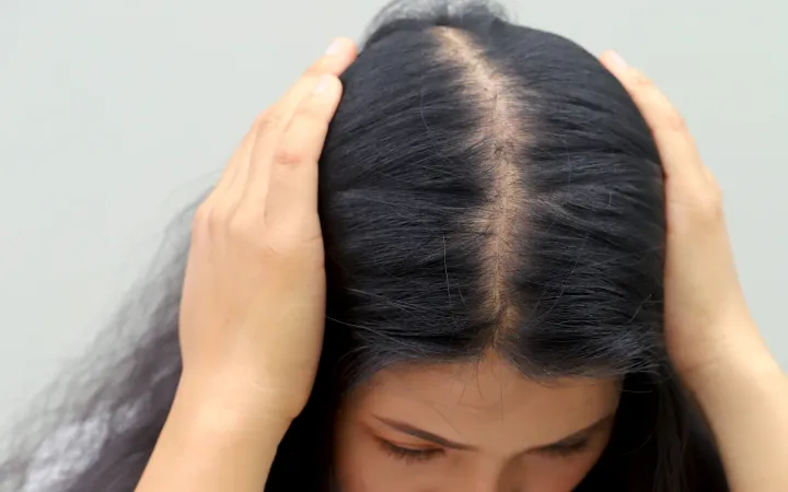 Hormonal Hair Loss Recovery: Step Two — The Scalp Must Stabilize First, or New Hair Won’t Hold