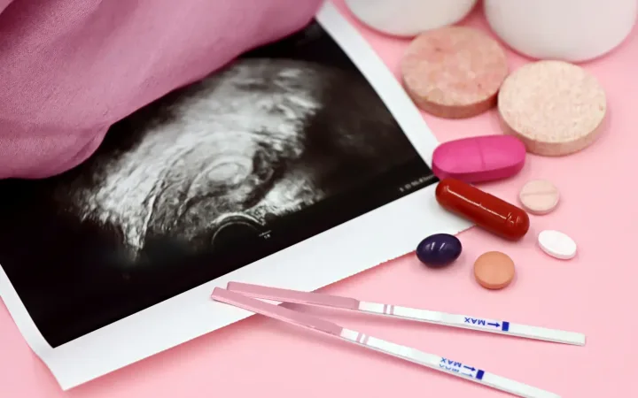 Hormonal Hair Loss Isn’t a Sign of a “Weak Body” —It’s About Hair Follicles Being More Sensitive to Hormonal Signals