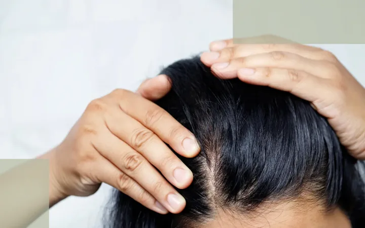 How to Care for Stress Hair Loss Why Real Recovery Comes from Stability, Not Stimulation