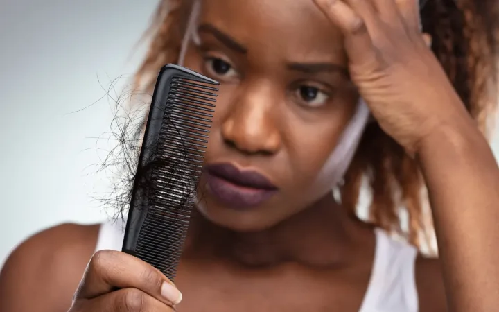 How to Distinguish Postpartum Hair Loss from Genetic Hair Loss The Clearest and Most Important Guide