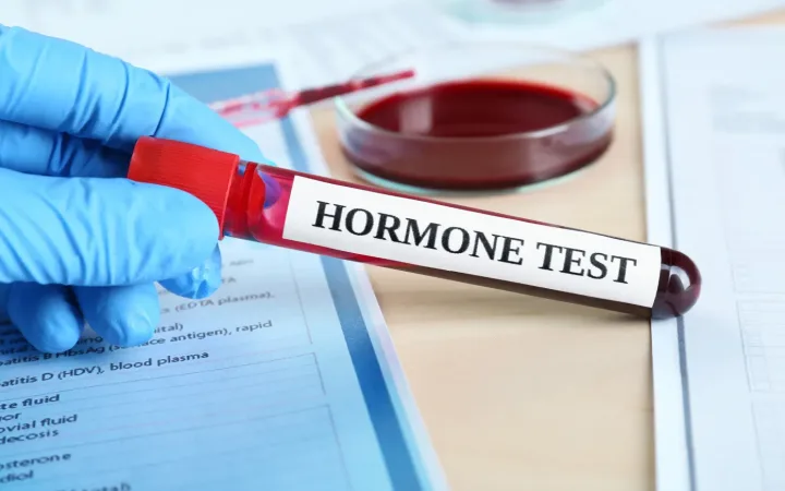 “Is Checking Hormones Enough”Which Tests Actually Inform — and Which Are Most Often Misinterpreted (A Practical Guide)