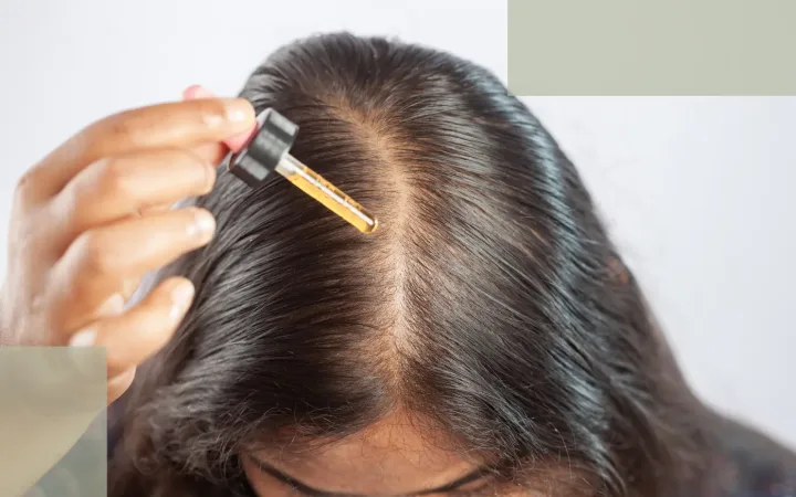 Minoxidil for Hair Loss Benefits, Limitations, and Gentle Alternatives (1)
