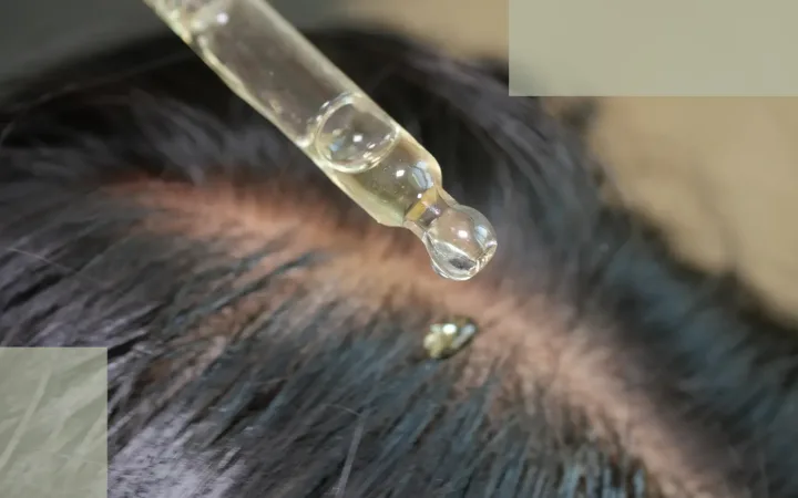 The Fifth Mechanism of Stress Hair Loss How Inflammation and Immune Signals Quietly Suppress Hair Growth