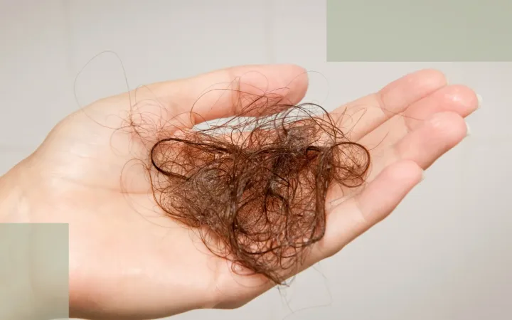Thyroid Hair Loss