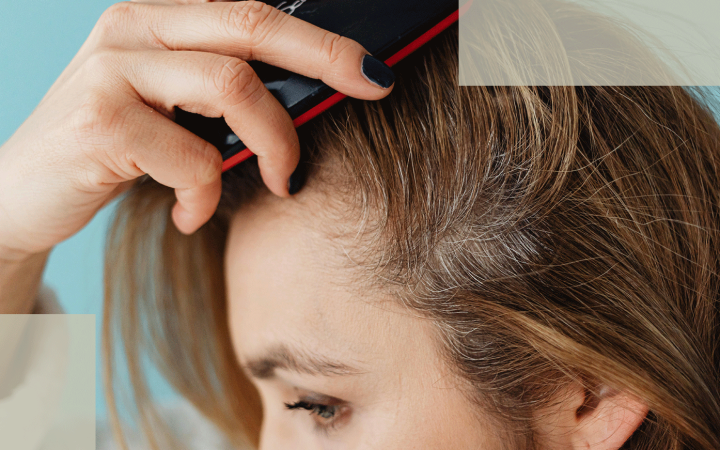 microneedling